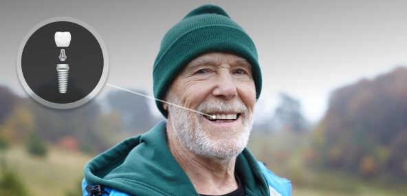 Dental Implants at Joobbani Dental Designs in Columbia, Maryland