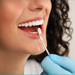 Dental Veneers at Joobbani Dental Designs in Columbia, Maryland