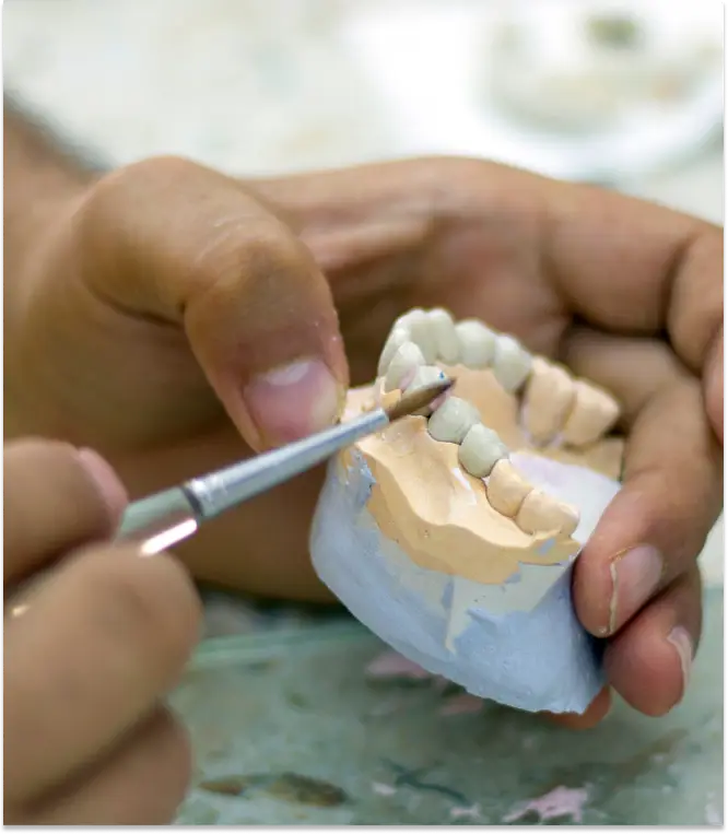 Full mouth reconstruction treatment