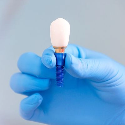 Single or Multiple Tooth Implants in Columbia, MD