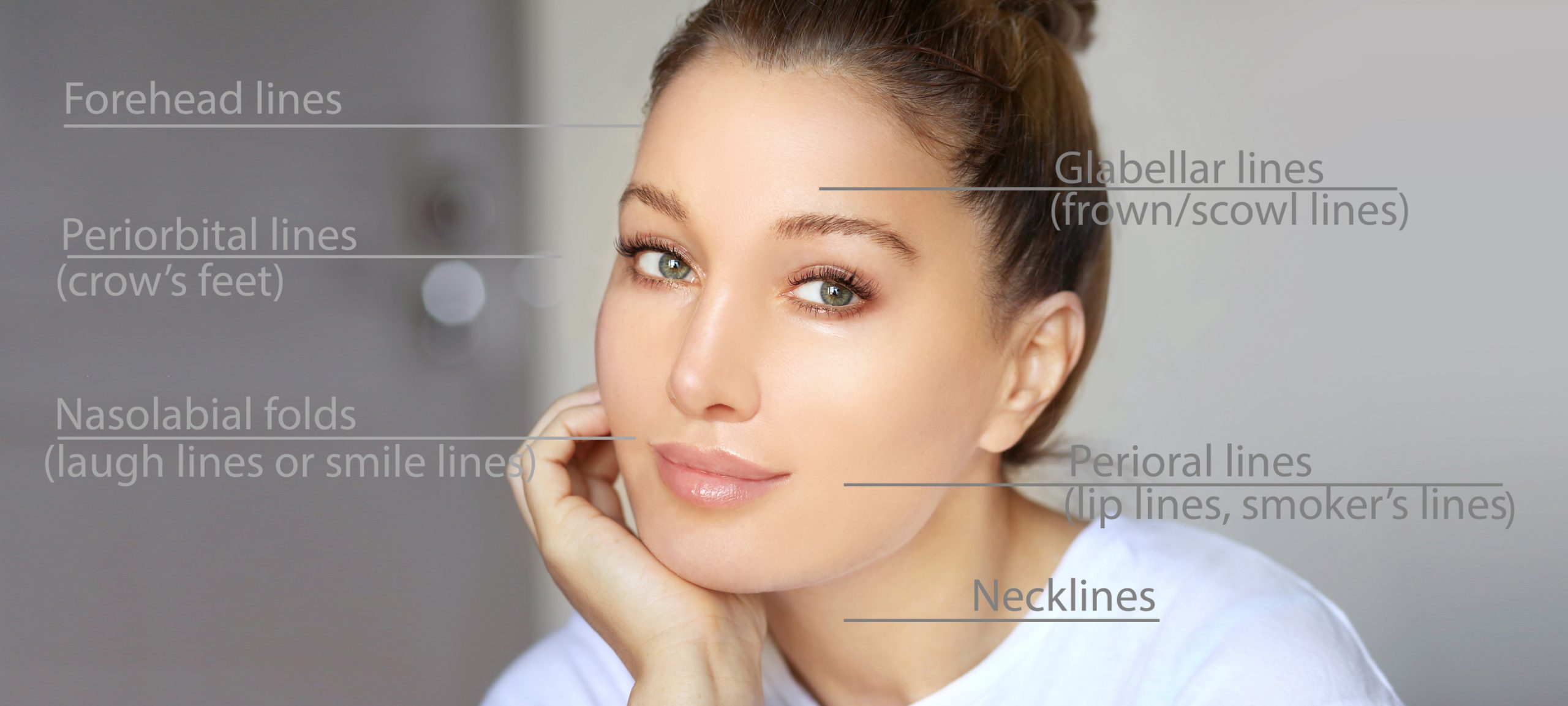 Dermal Fillers